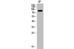 Western Blot analysis of KB cells using Phospho-PI 3-kinase p85α (Y607) Polyclonal Antibody (PIK3R1 antibody  (pTyr607))