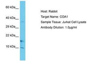 Image no. 1 for anti-UBX Domain Protein 11 (UBXN11) (C-Term) antibody (ABIN6750641) (UBXN11 antibody  (C-Term))