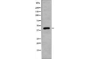 Western blot analysis of extracts from 293 cells using CBX6 antibody. (CBX6 antibody  (N-Term))