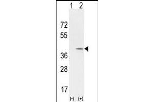 Western blot analysis of CCND1 (arrow) using rabbit polyclonal CCND1 Antibody (Center) (Cat. (Cyclin D1 antibody  (AA 147-175))