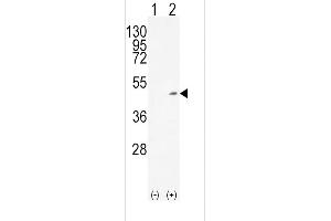 Western blot analysis of ADH1C using rabbit polyclonal ADH1C Antibody using 293 cell lysates (2 ug/lane) either nontransfected (Lane 1) or transiently transfected (Lane 2) with the ADH1C gene. (ADH1C antibody  (AA 231-260))