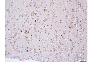 Formalin-fixed and paraffin embedded rat brain labeled with Anti-NF2/Neurofibromin 2 Polyclonal Antibody, Unconjugated  at 1:200 followed by conjugation to the secondary antibody and DAB staining (Merlin antibody  (AA 401-550))