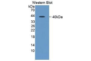 Western blot analysis of recombinant Human SDF1. (CXCL12 antibody)