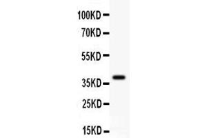 Anti- GAD67 Picoband antibody, Western blottingAll lanes: Anti GAD67  at 0. (GAD antibody  (AA 14-122))