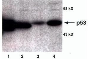 Each lane contains 50µg of total cellular protein separated by 10% SDS-PAGE. (p53 antibody)