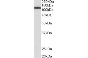 Western Blotting (WB) image for anti-Myosin IB (MYO1B) antibody (ABIN5881568) (Myosin IB antibody)