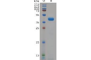 Human K Protein, hFc Tag on SDS-PAGE under reducing condition. (KCNK9 Protein (AA 30-79) (Fc Tag))