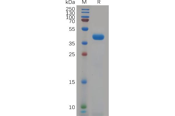 KCNK9 Protein (AA 30-79) (Fc Tag)