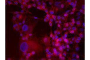 Immunofluorescence (IF) image for anti-Integrin beta 3 (ITGB3) antibody (Alexa Fluor 647) (ABIN2657833) (Integrin beta 3 antibody  (Alexa Fluor 647))