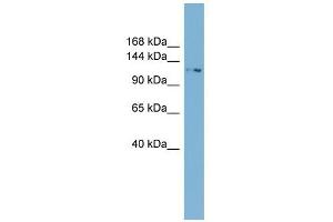 TTC17 antibody used at 1 ug/ml to detect target protein. (TTC17 anticorps  (N-Term))