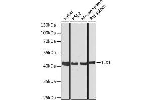 Western blot analysis of extracts of various cell lines, using TLX1 antibody (ABIN6293011) at 1:3000 dilution. (TLX1 antibody)