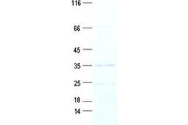 KNSTRN Protein (Transcript Variant 3) (Myc-DYKDDDDK Tag)