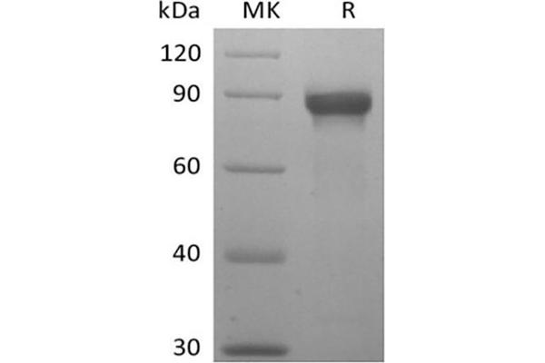 SIGLEC8 Protein (mFc Tag)