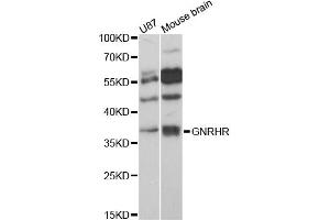 Western blot analysis of extracts of various cell lines, using GNRHR antibody (ABIN6292108) at 1:3000 dilution. (GNRHR antibody)