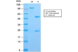 SDS-PAGE (SDS) image for anti-S100 Calcium Binding Protein A4 (S100A4) (AA 1-200) antibody (ABIN6940545)