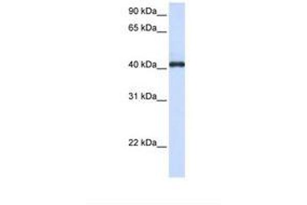 FCRLA antibody  (C-Term)