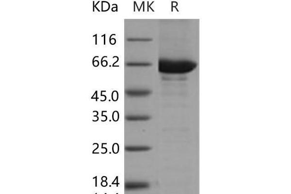 CSK Protein (GST tag,His tag)