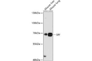 Western blot analysis of extracts of various cell lines, using SRF antibody (ABIN7270257) at 1:1000 dilution. (SRF antibody  (AA 1-280))