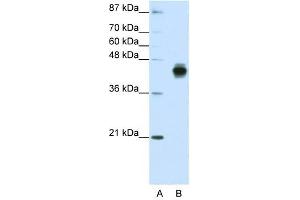 Cytokeratin 18 antibody used at 1. (Cytokeratin 18 antibody  (C-Term))