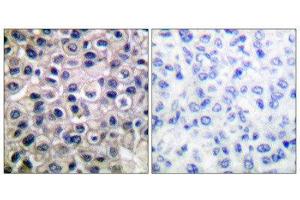 Immunohistochemistry (IHC) image for anti-Matrix Metallopeptidase 14 (Membrane-inserted) (MMP14) (C-Term) antibody (ABIN1848674) (MMP14 antibody  (C-Term))