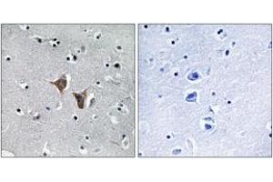 Immunohistochemistry analysis of paraffin-embedded human brain, using WASF4 Antibody. (WASF4 antibody  (AA 190-239))