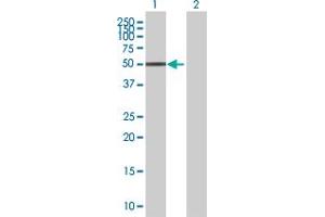 Lane 1: RARB transfected lysate ( 50. (RARB 293T Cell Transient Overexpression Lysate(Denatured))