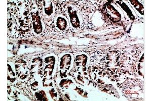 Immunohistochemical analysis of paraffin-embedded human-colon, antibody was diluted at 1:200 (VHL antibody  (AA 1-50))