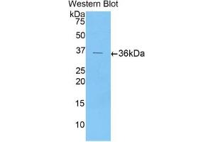 Detection of Recombinant ENA78, Human using Polyclonal Antibody to Epithelial Neutrophil Activating Peptide 78 (ENA78) (CXCL5 antibody  (AA 38-114))