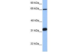 WB Suggested Anti-SF1  Antibody Titration: 0. (Splicing Factor 1 antibody  (C-Term))