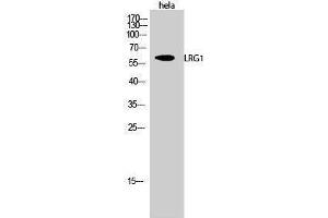 Western Blotting (WB) image for anti-Leucine-Rich alpha-2 Glycoprotein 1 (LRG1) (C-Term) antibody (ABIN3175867) (LRG1 antibody  (C-Term))