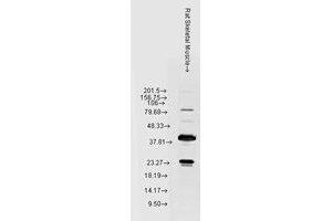 Hsp22 Western Blot. (HSPB8 antibody)