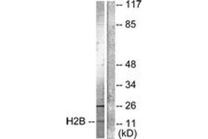 Western blot analysis of extracts from Raw264. (Histone H2B antibody  (acLys15))