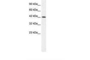 Image no. 1 for anti-Y Box Binding Protein 1 (YBX1) (AA 236-285) antibody (ABIN6735879) (YBX1 antibody  (AA 236-285))