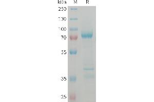 Human Protein, hFc Tag on SDS-PAGE under reducing condition. (MSTN Protein (AA 24-375) (Fc Tag))