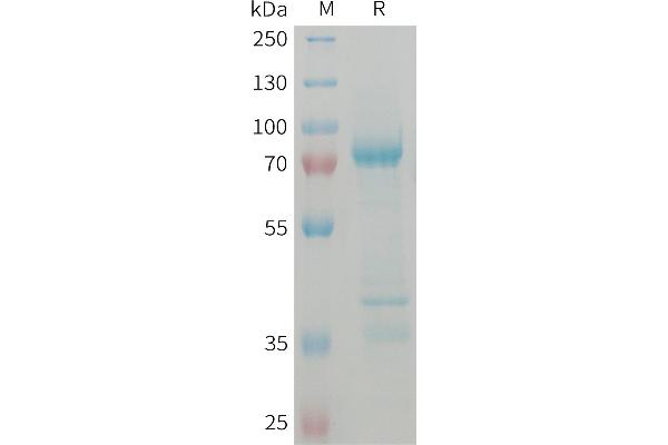 MSTN Protein (AA 24-375) (Fc Tag)