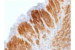 Immunohistochemistry (IHC) image for anti-Calponin 1 (CNN1) antibody (ABIN6939166)