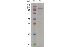 MMP13 Protein (AA 20-148) (Fc Tag)