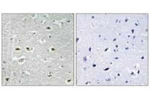 Immunohistochemistry analysis of paraffin-embedded human brain tissue using URB1 antibody. (URB1 antibody  (C-Term))