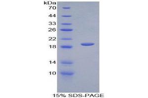 SDS-PAGE (SDS) image for alpha-2-Glycoprotein 1, Zinc-Binding (AZGP1) (AA 148-298) protein (His tag) (ABIN1879287) (AZGP1 Protein (AA 148-298) (His tag))