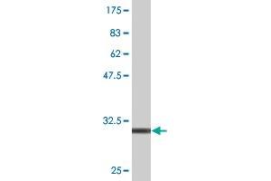 Western Blot detection against Immunogen (32. (HDGF antibody  (AA 184-240))