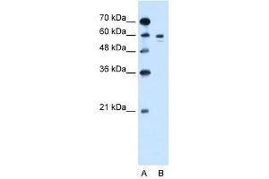 TYR antibody used at 1. (TYR antibody)