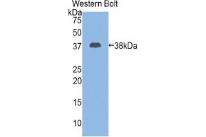 Detection of Recombinant CSTA, Mouse using Polyclonal Antibody to Cystatin A (CSTA) (CSTA antibody  (AA 1-97))
