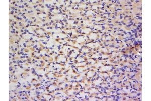 Formalin-fixed and paraffin embedded rat gastric tissue labeled with Anti-Glutamyl Prolyl tRNA synthetase/ProRS Polyclonal Antibody, Unconjugated  at 1:200 followed by conjugation to the secondary antibody and DAB staining. (EPRS antibody  (AA 651-750))