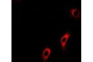 Immunofluorescent analysis of ACADS staining in U2OS cells. (ACADS antibody)