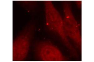 Immunofluorescence staining of methanol-fixed HeLa cells using Phospho-ABL1-Y412 antibody (ABIN2987872). (ABL1 antibody  (pTyr412))