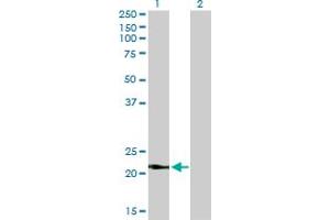 Western Blot analysis of VSNL1 expression in transfected 293T cell line by VSNL1 monoclonal antibody (M01), clone 2F1-E3. (VSNL1 antibody  (AA 1-191))