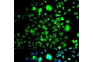 Immunofluorescence analysis of A549 cells using PEX14 Polyclonal Antibody (PEX14 antibody)