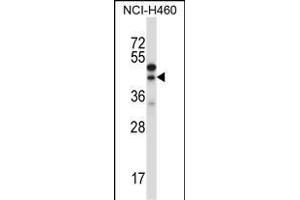 CTGF Antibody (Center) (ABIN657322 and ABIN2846396) western blot analysis in NCI- cell line lysates (35 μg/lane). (CTGF antibody  (AA 166-193))