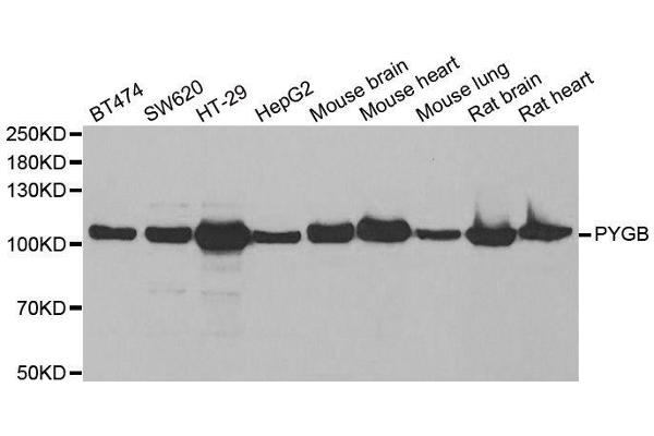 PYGB antibody  (AA 544-843)