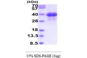 SDS-PAGE (SDS) image for Fc Fragment of IgE, Low Affinity II, Receptor For (CD23) (FCER2) (AA 48-321) protein (His tag) (ABIN7281312) (FCER2 Protein (AA 48-321) (His tag))